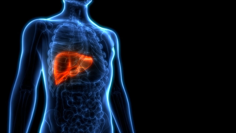 Illustration of liver tumor
